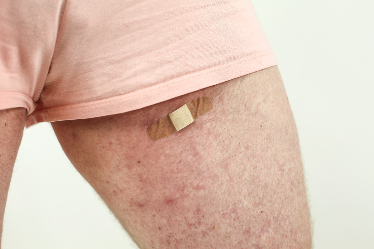 legs-bandge.jpg
