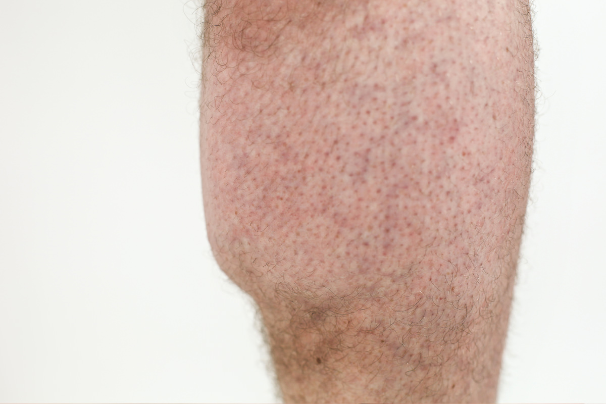 legs-calf.jpg
