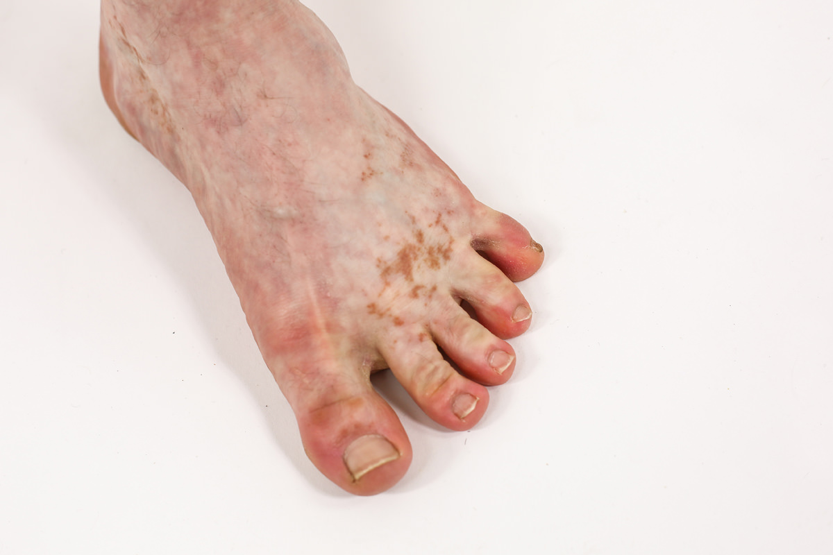 legs-foot.jpg