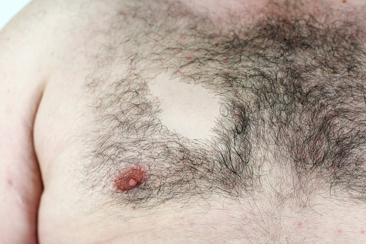 torso-bald_spot.jpg