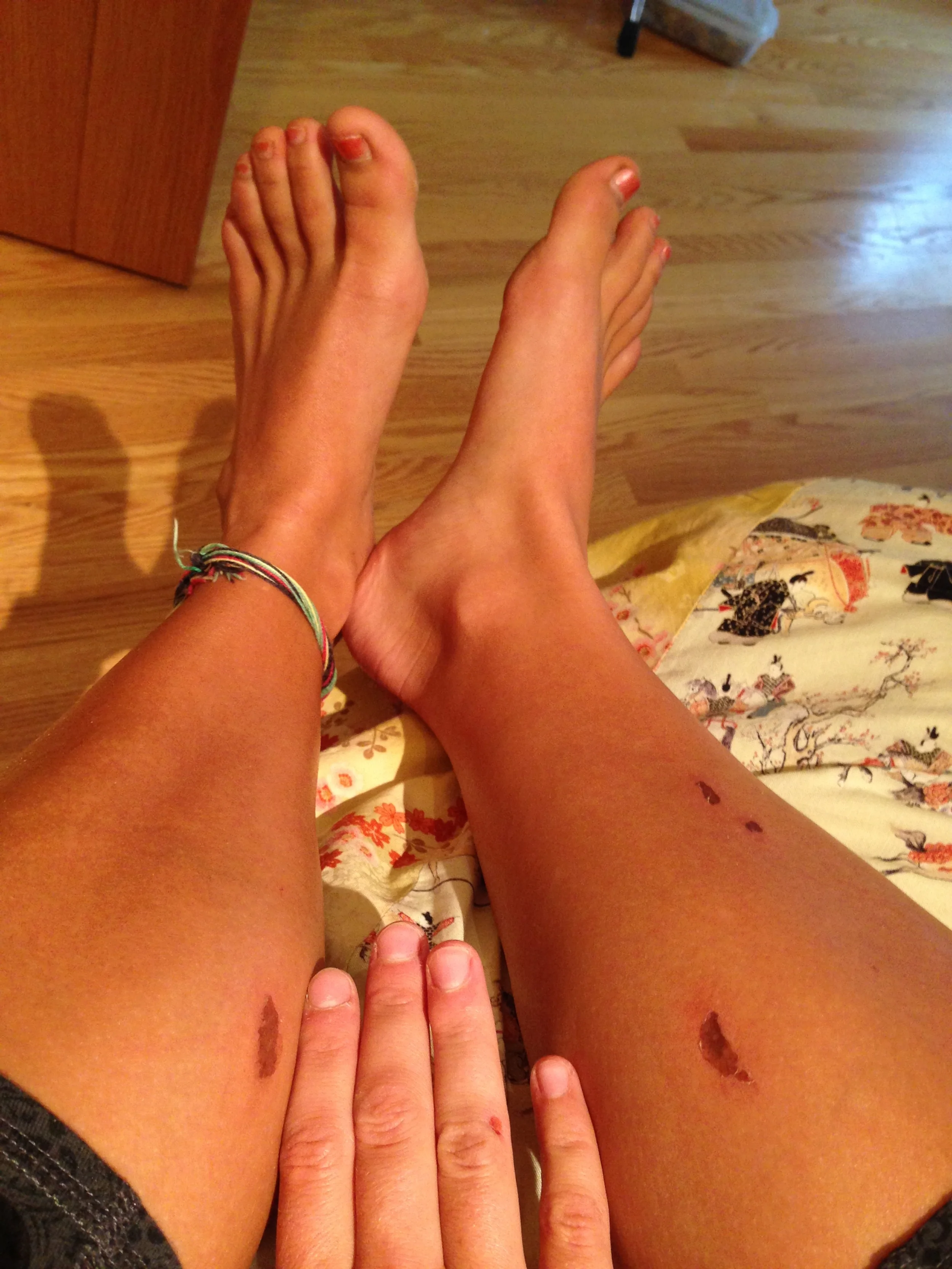 saddle rubs...