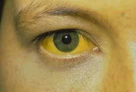 A sickly yellow.....human skin tone and eyes. 