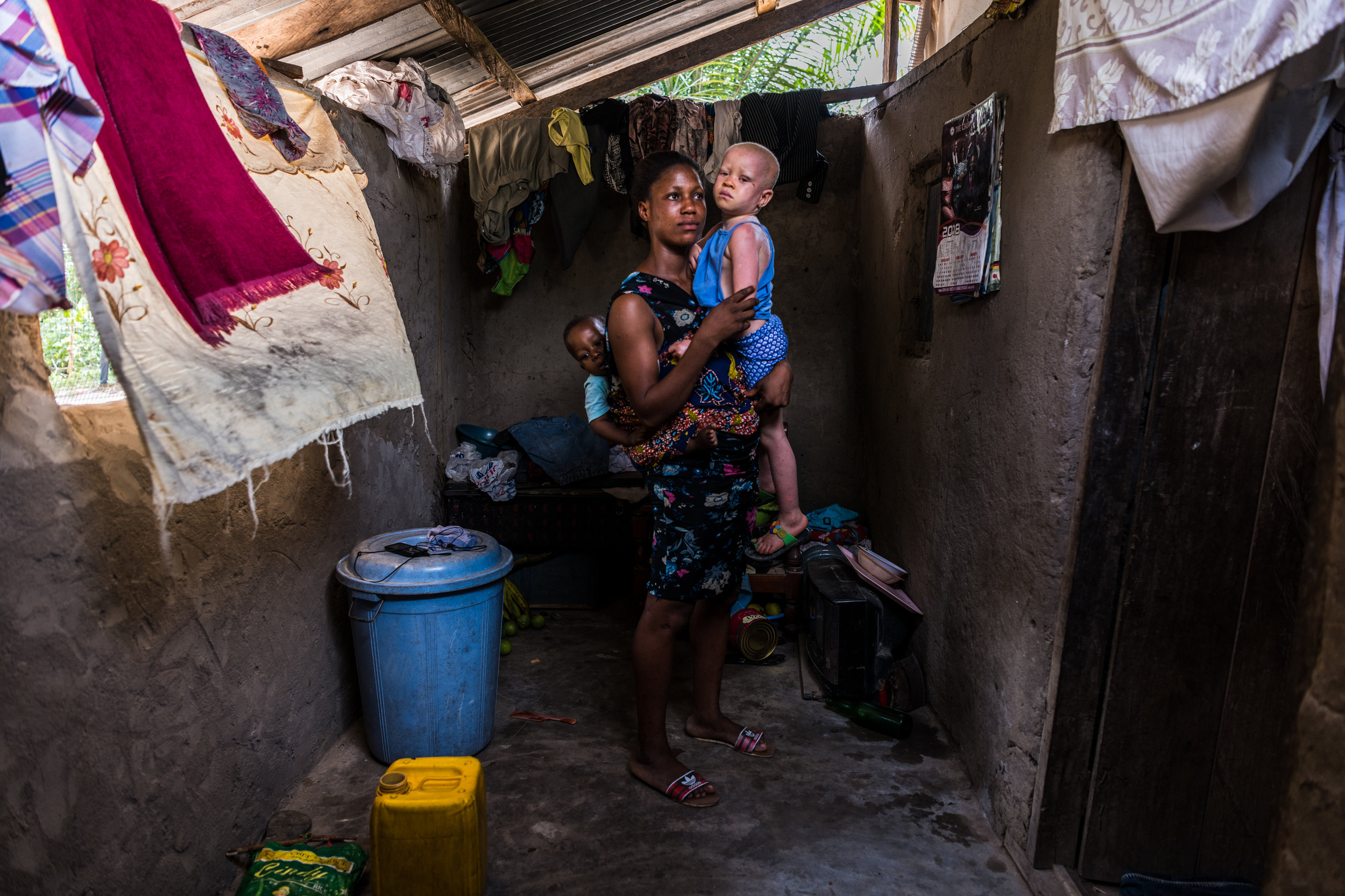 In recent years, a community of people living with albinism have forged connections