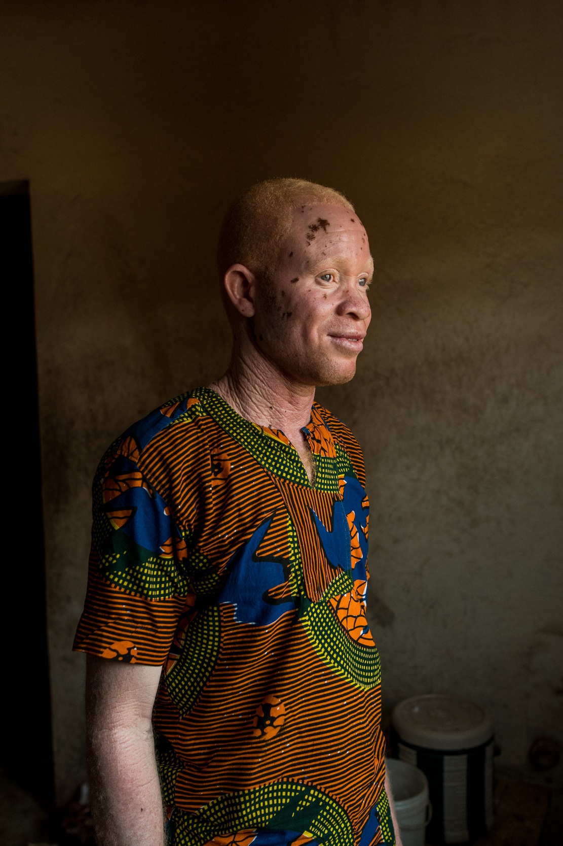 “When he was rushed to the hospital, they didn’t pay attention to him in the hospital and he eventually died,” he said. “We assume he wasn’t cared for because he had albinism because the nurses were afraid to treat him. But we had no evidence and co
