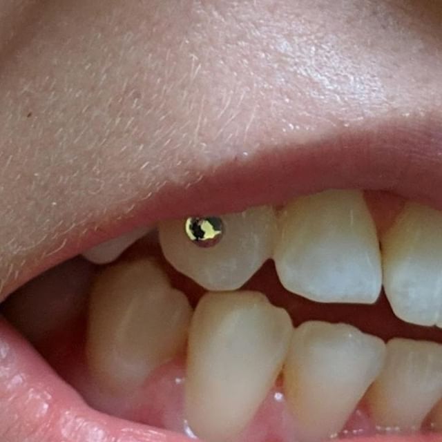 Cute little CZ gem I did 🦷✨⁠
Email info@thetattooery.com for appointments⁠
.⁠
.⁠
.⁠
#toothgem #toothgems #toothjewelry #dentaljewelry #designersmile #smilemakeover #toothbling #twinkles #mdtoothgems #dctoothgems #dmvtoothgems #thetattooery