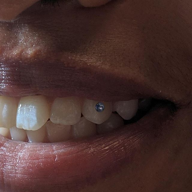 IN LOVE with these little periwinkle gems! 🦷✨⁠
Email info@thetattooery.com for appointments⁠
.⁠
.⁠
.⁠
#toothgem #toothgems #toothjewelry #dentaljewelry #designersmile #smilemakeover #toothbling #twinkles #mdtoothgems #dctoothgems #dmvtoothgems #thet