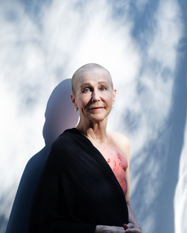 Breast Cancer Survivor Portrait Scaperoth Wiseman (6 of 9).jpg
