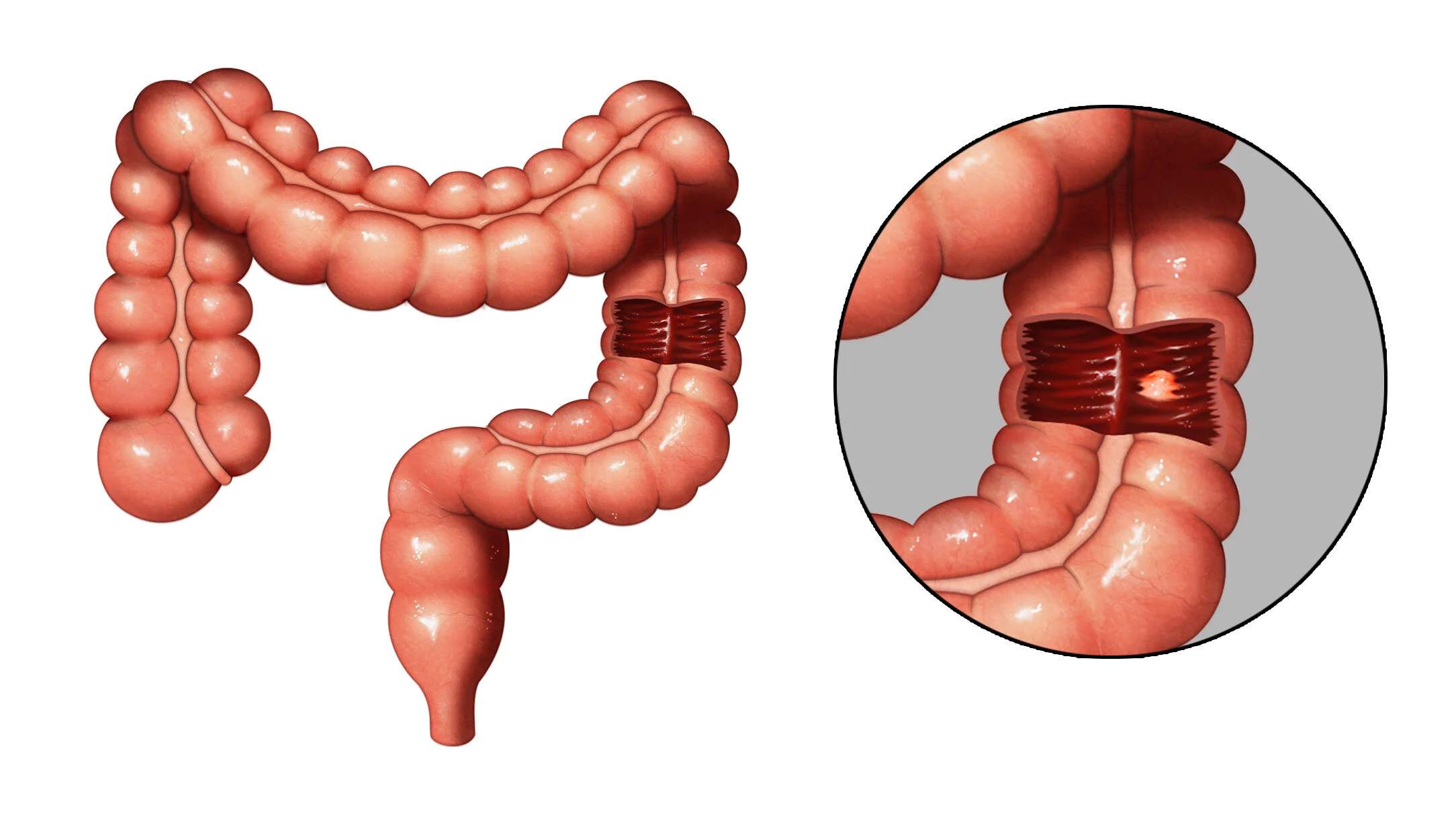 Colon6.jpg