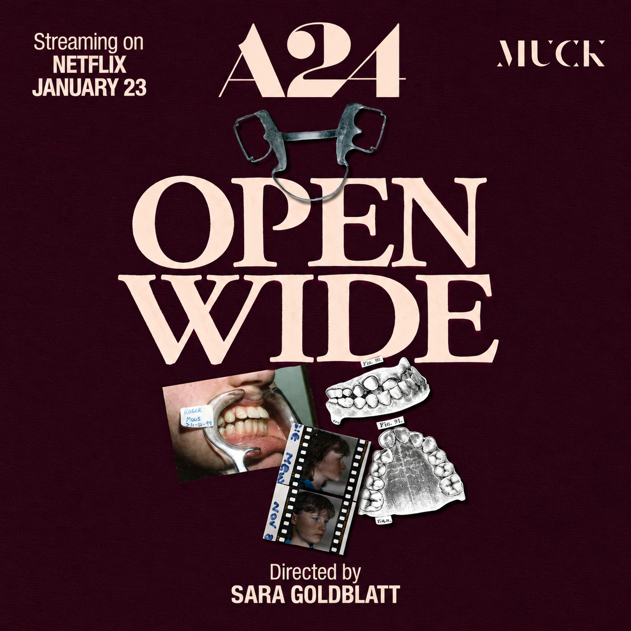 A24 Open Wide Dental Collage.png