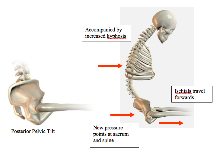 This image from www.clinical-corner.com basically just reinforces this idea. Wow! That looks uncomfortable...but we all do it sometimes. It is also possible to be anterior tilting the pelvic too much, though that's more difficult to do while playing an instrument.