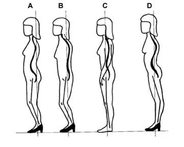 Here are a few other postural variations- the first example is similar to the above image, the second shoes more thoracic slumping, the third shows a neutral position, and the fourth shoes the hyperextension of the knees leading to forward thrusting…