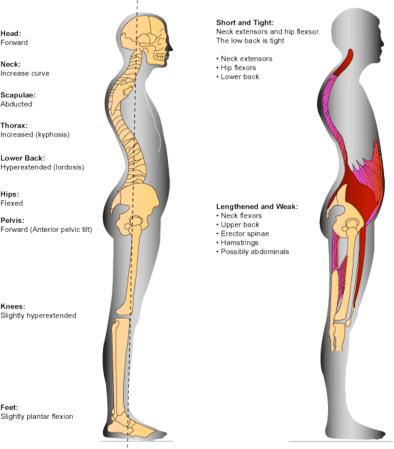 Our environment is conspiring to keep you slouched, head forward, chest tight, and with weak shoulders. Your yoga practice may be making that worse!