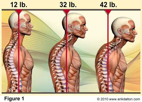Smartphones invite us to slouch our spines and bring our heads forward to look down.
