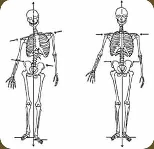 Some forms of manual therapy aim to change structural imbalances, asymmetry, etc.  This is an image often used in different rolfing and structural integration practices.