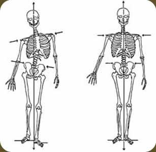 Some forms of manual therapy aim to change structural imbalances, asymmetry, etc. This is an image often used in different rolfing and structural integration practices.