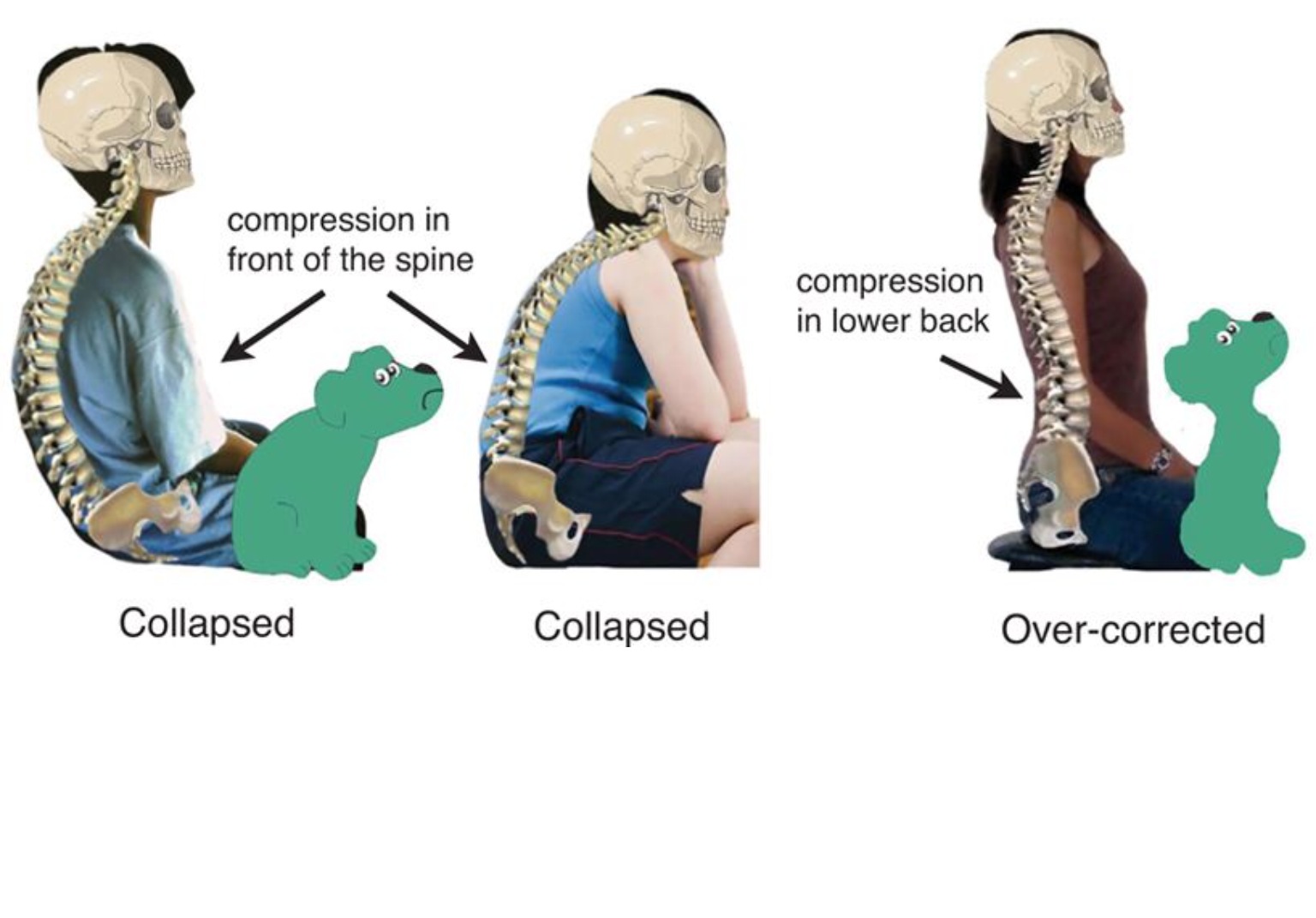  Notice how the two postures on the left are of an excessive kyphosis and the image on the right is excessive lordosis.&nbsp; Image from "Sad Dog, Happy Dog" by Kathleen Porter. 
