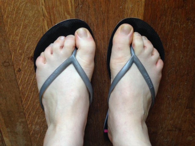 Are your toes drifting towards each other? Or is there space between your toes?