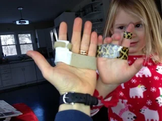 Pre-surgical splint to immobilize MCP joint and a kid version designed and built out of duct tape by my youngest child.