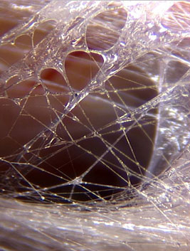This is an image from Dr Jean-Claude Guimberteau's Strolling Under the Skin , which takes a look at living human fascia!