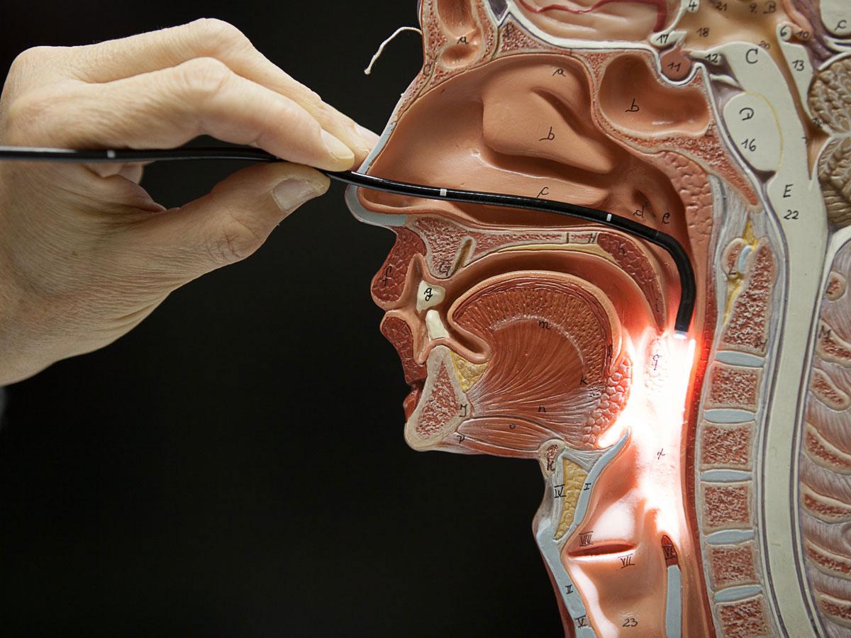 This image from www.voicedoctor.net does an excellent job of showing the nasal pathway of studying the vocal folds. 