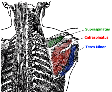 The infraspinatus and trees minor are key muscles to look at strengthening.