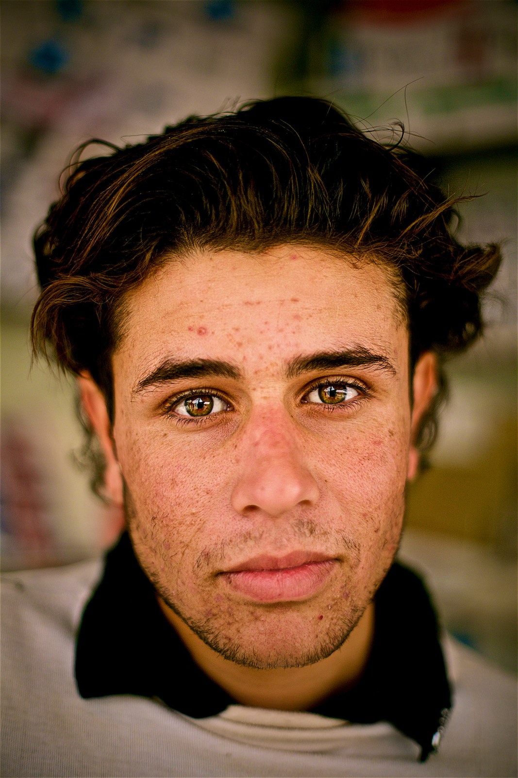 Majd says that the constant dust-storms and lack of proper structure for hygiene (lack of running water, for example), makes everyone sick for prolonged periods of time here. He especially loathes the acne that developed on his face after his arriva
