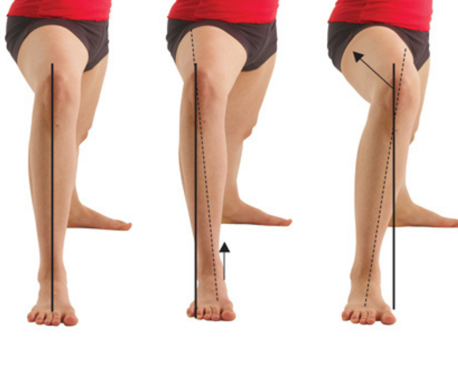 Knock, knock …It’s your knees! — Body Align