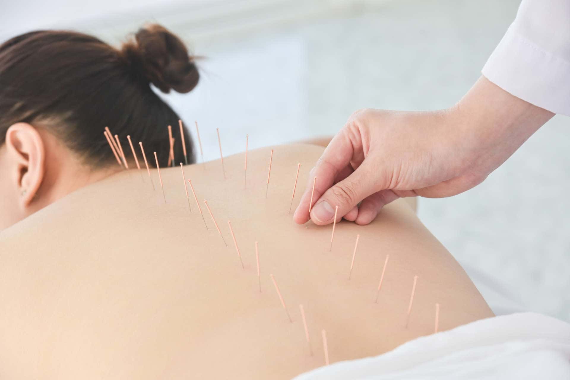 Acupuncture for Low .png
