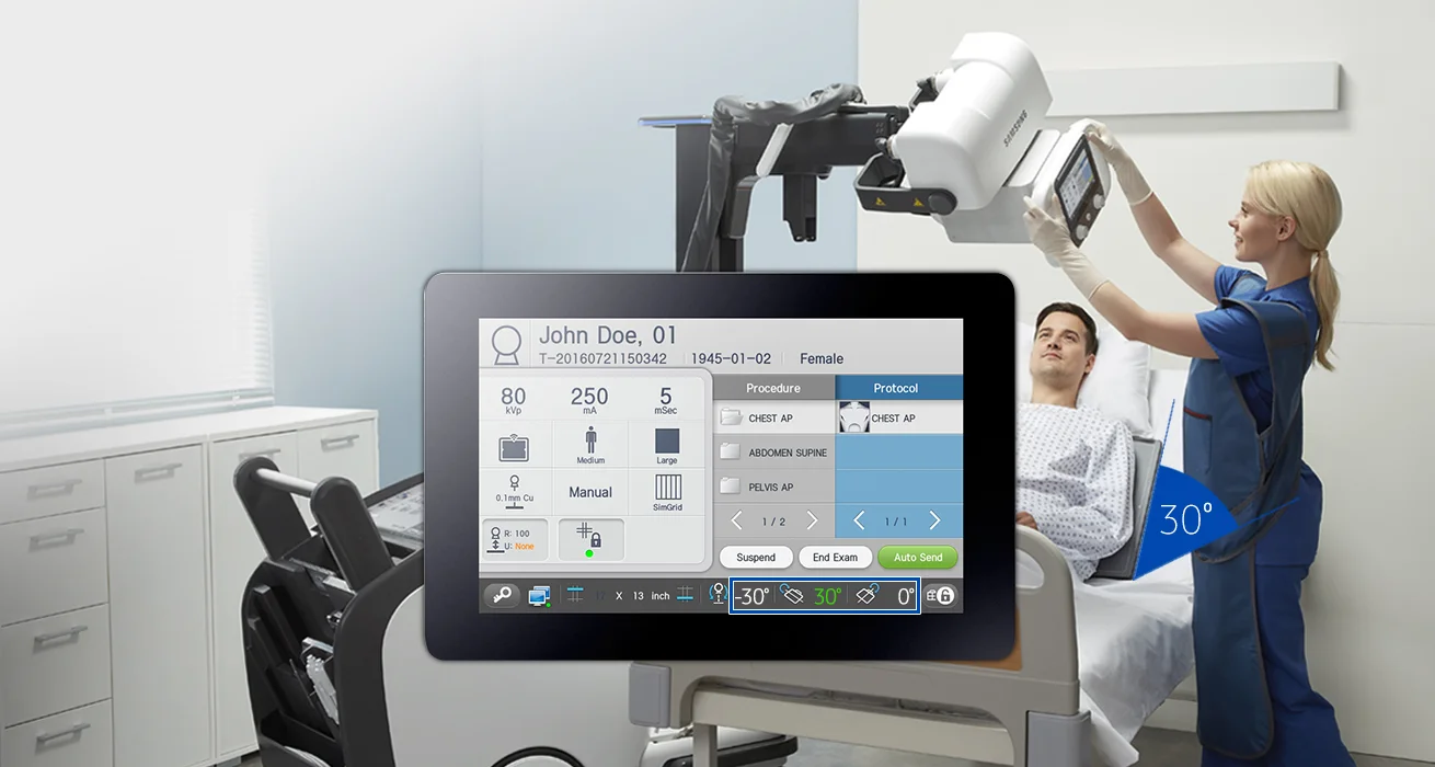 S-Align S-Align provides precise alignment for superior imaging. The angle of the detector is displayed on the THU (Tube Head Unit) to enhance image quality during free exams. When the THU and detector are within a certain radius, the angle can be automatically fitted.