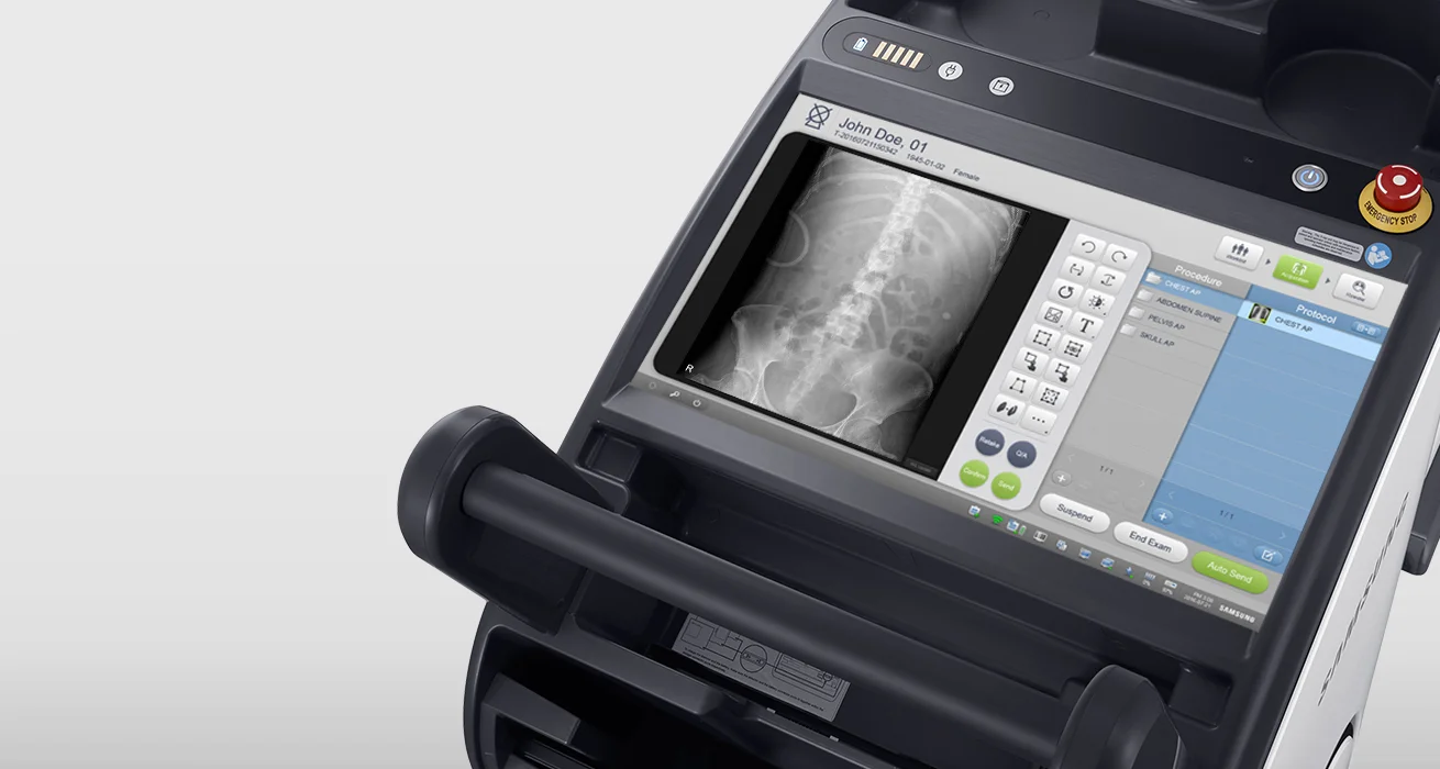 S-Vue Samsung's S-Vue imaging engine delivers dependable and accurate diagnoses through advanced processing and adaptive filtering and provides enhanced image contrast and sharpness.