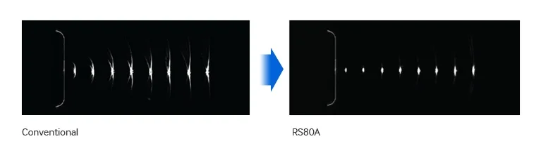 S-Vision beamformer The S-Vision beam former receives returning signals through a sophisticated digital filtering system resulting in reduced side lobes, less noise and artifact.