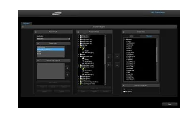 EZ-Exam+ EZ-Exam+ transforms multiple ultrasound investigation steps into a streamlined process. It enables users to build a fast and convenient diagnostic environment by storing optimized, preferred protocols with the EZ-Exam+ function control.
