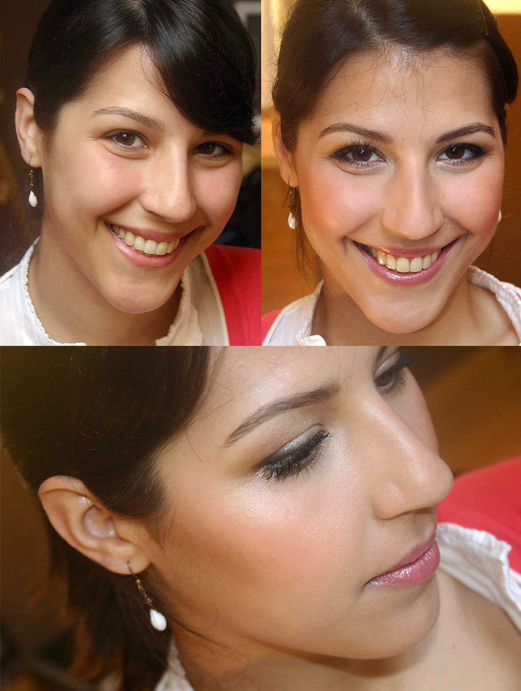 b-antes-e-depois.jpg