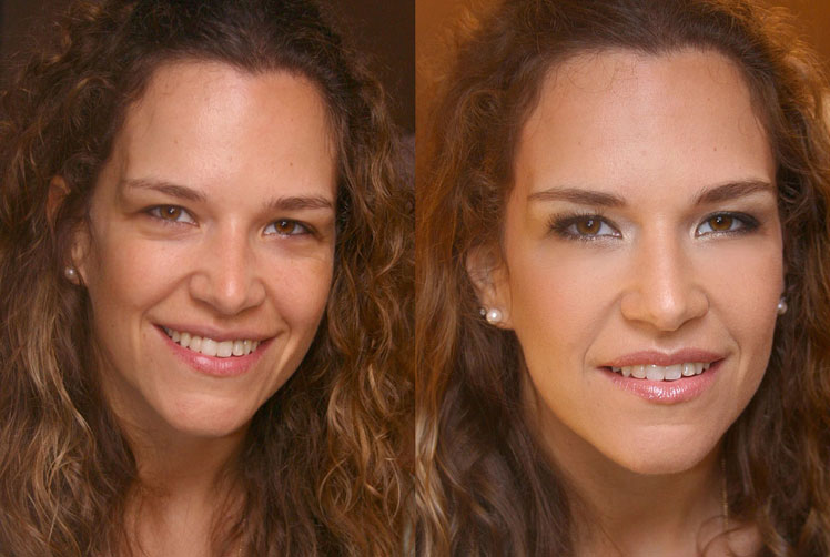 j-antes-e-depois.jpg