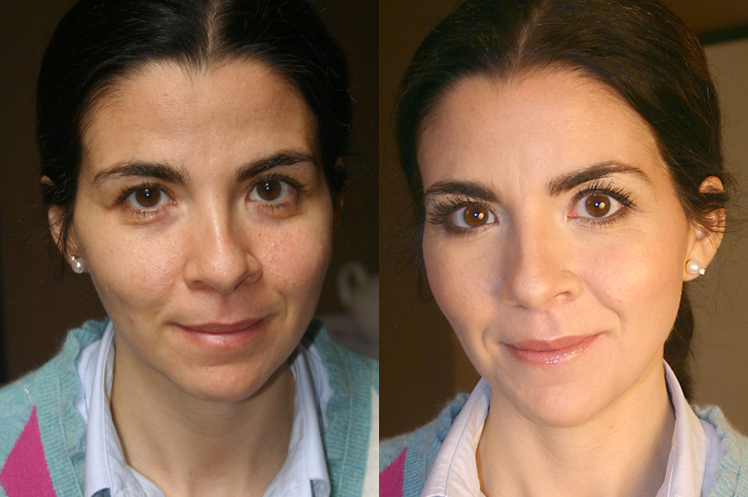 C A antes e depois.jpg