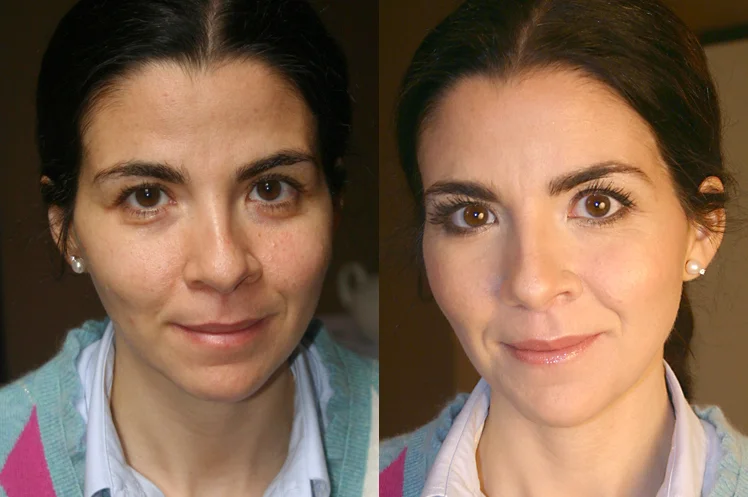 C A antes e depois.jpg