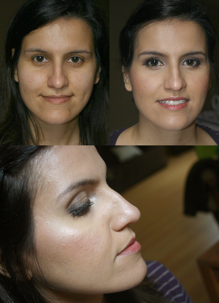 Carolina antes e depois.jpg