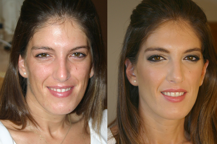 marta_before&after.jpg