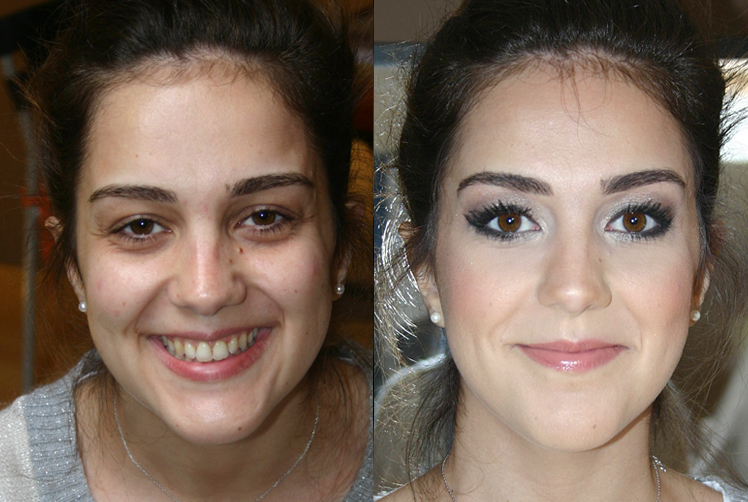 elodie-antes-e-depois.jpg