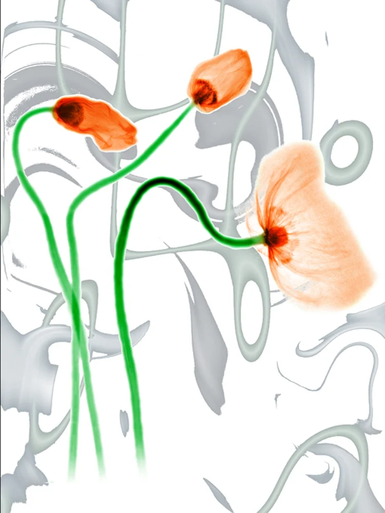___mohnblumen2+f*.jpg