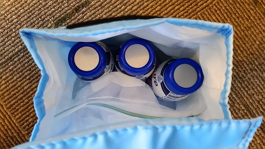 Second Jaw Surgery Recovery Days 2932 Rubber bands — Jaw Surgery