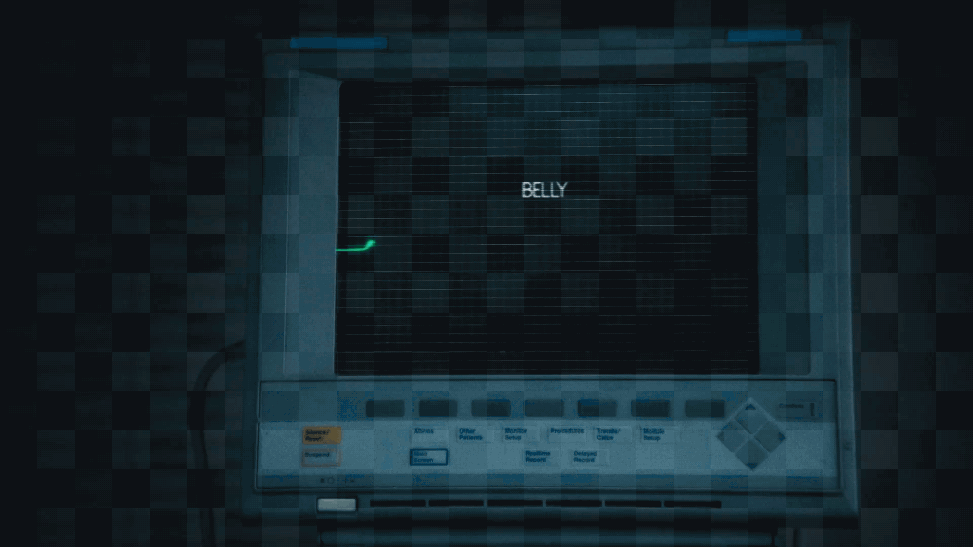 Belly_1.gif