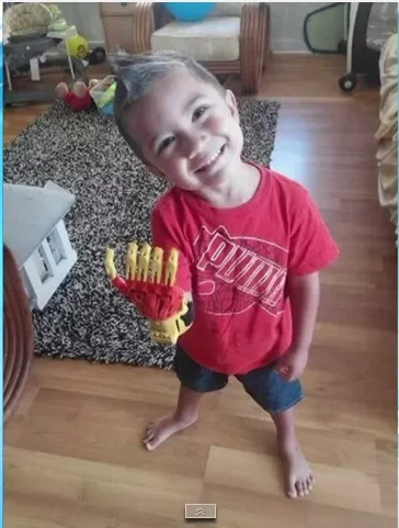 男童喜獲鋼鐵人手臂!!