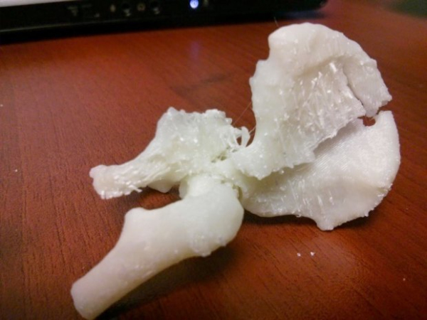 3D列印在醫學上的應用.png