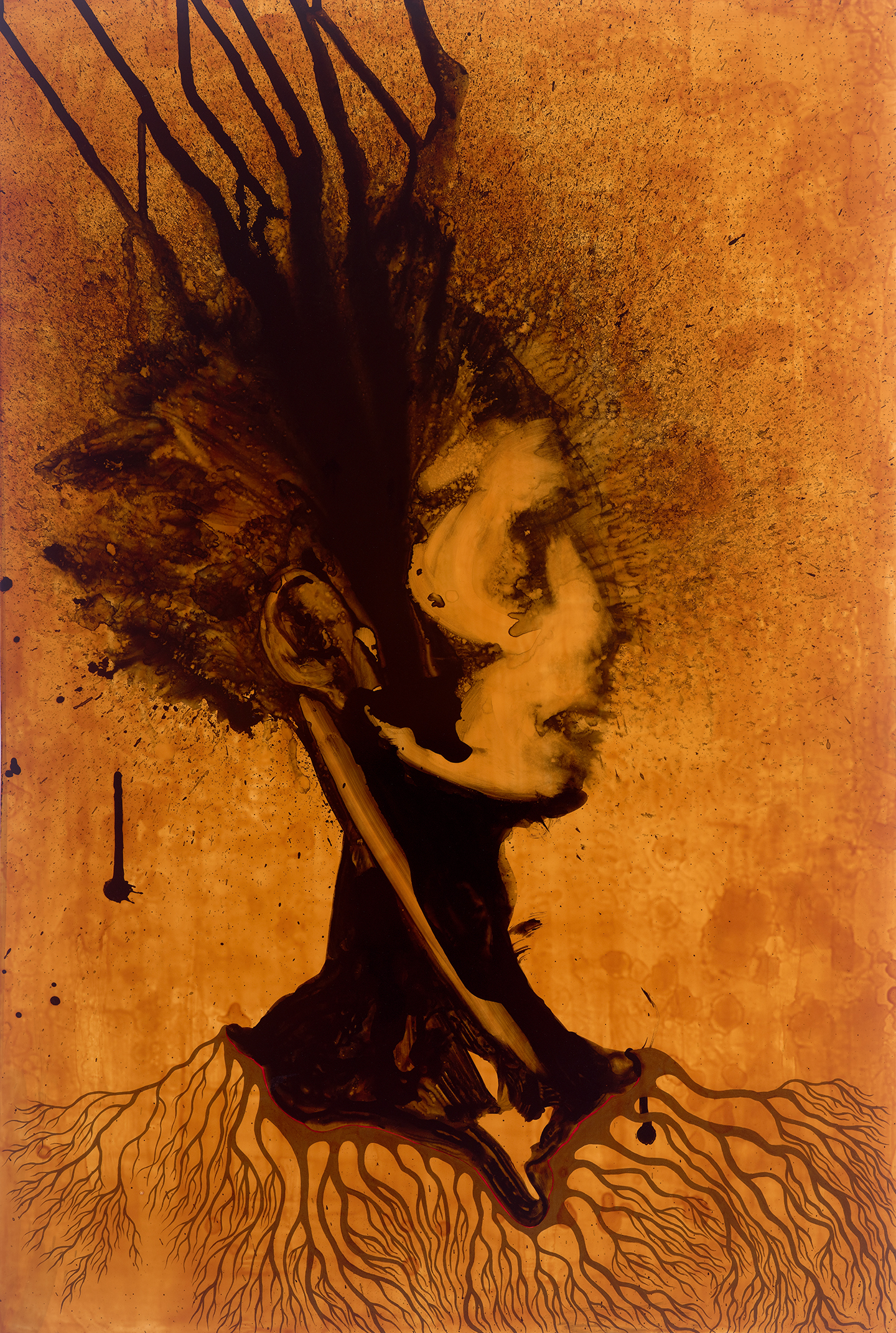 Parasomnia