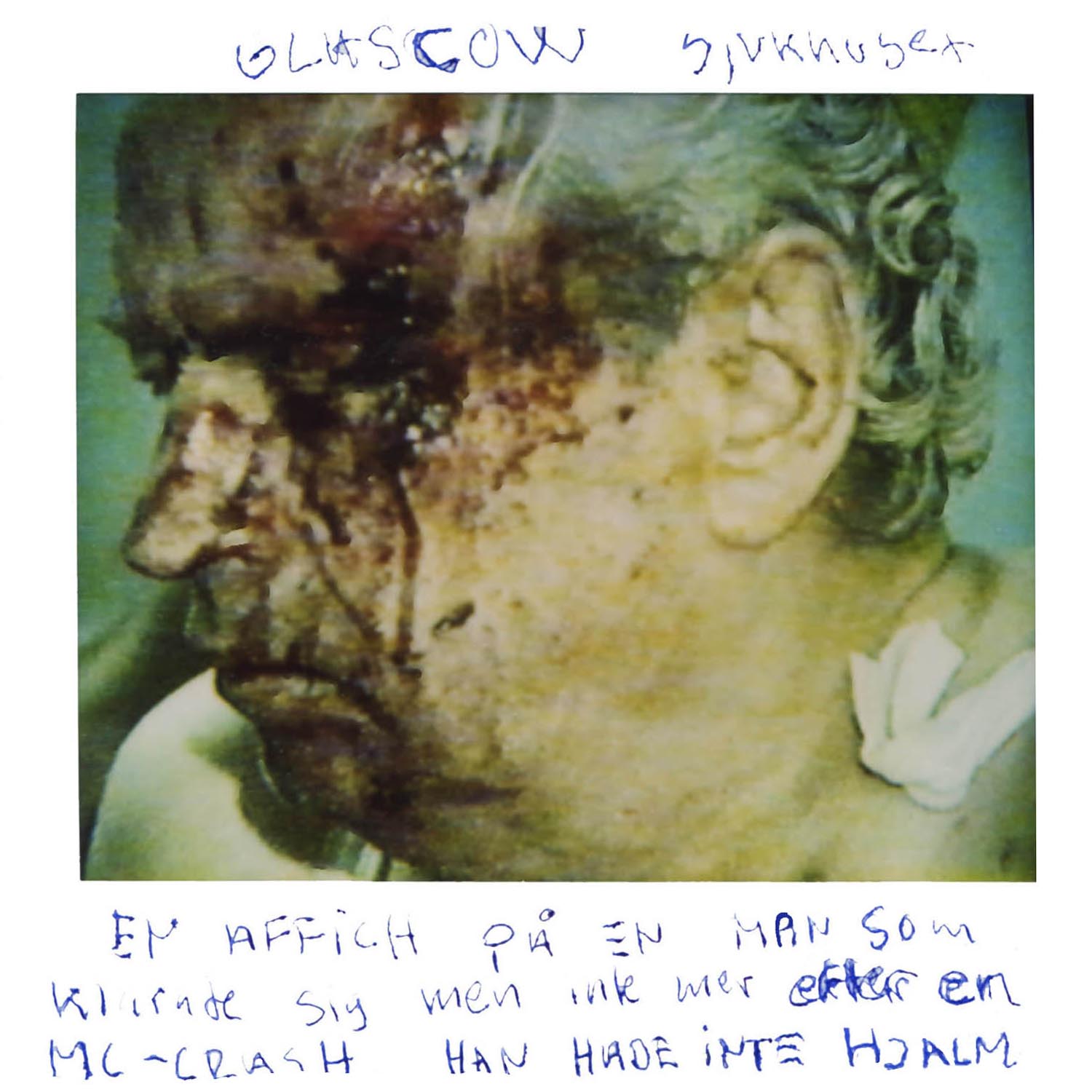This poster hung on the hospital wall in Glasgow. The man made it but just.. after a MC crash ... He had no helmet 