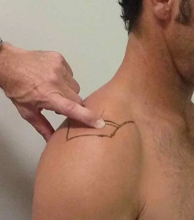 Demonstrating the position of the acromio-clavicular joint. Palpation of this joint is important in assessment of possible shoulder dislocations.