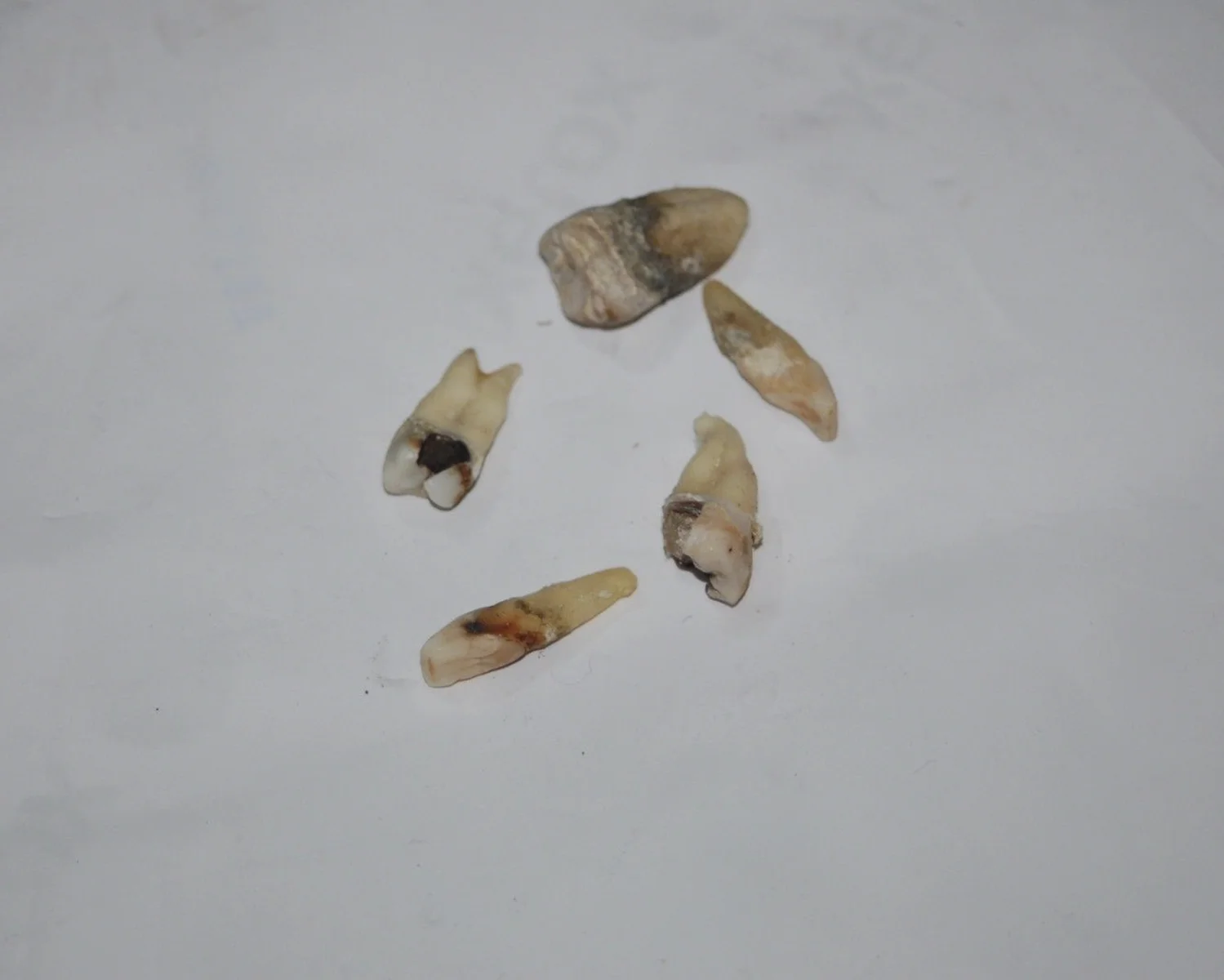Teeth.jpg