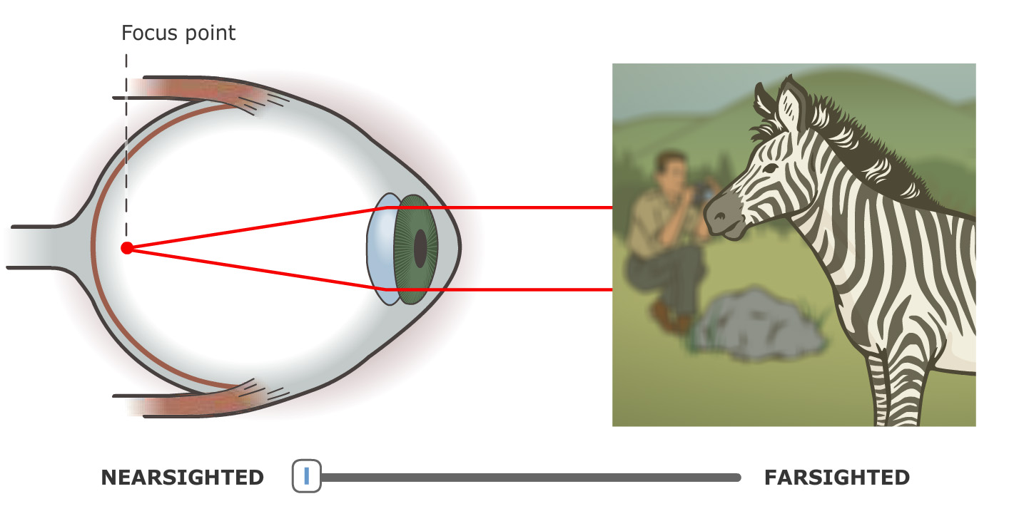 Nearsighted/Farsighted diagram