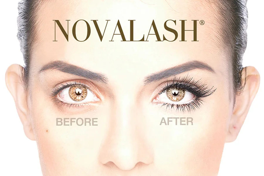 novalash-before-after-900x600.jpg
